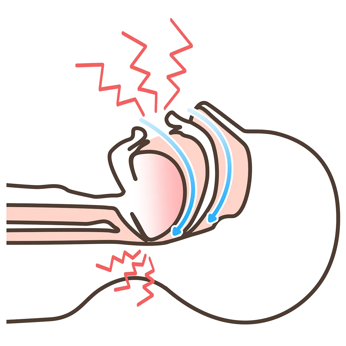 睡眠時無呼吸症候群 正常 イラスト