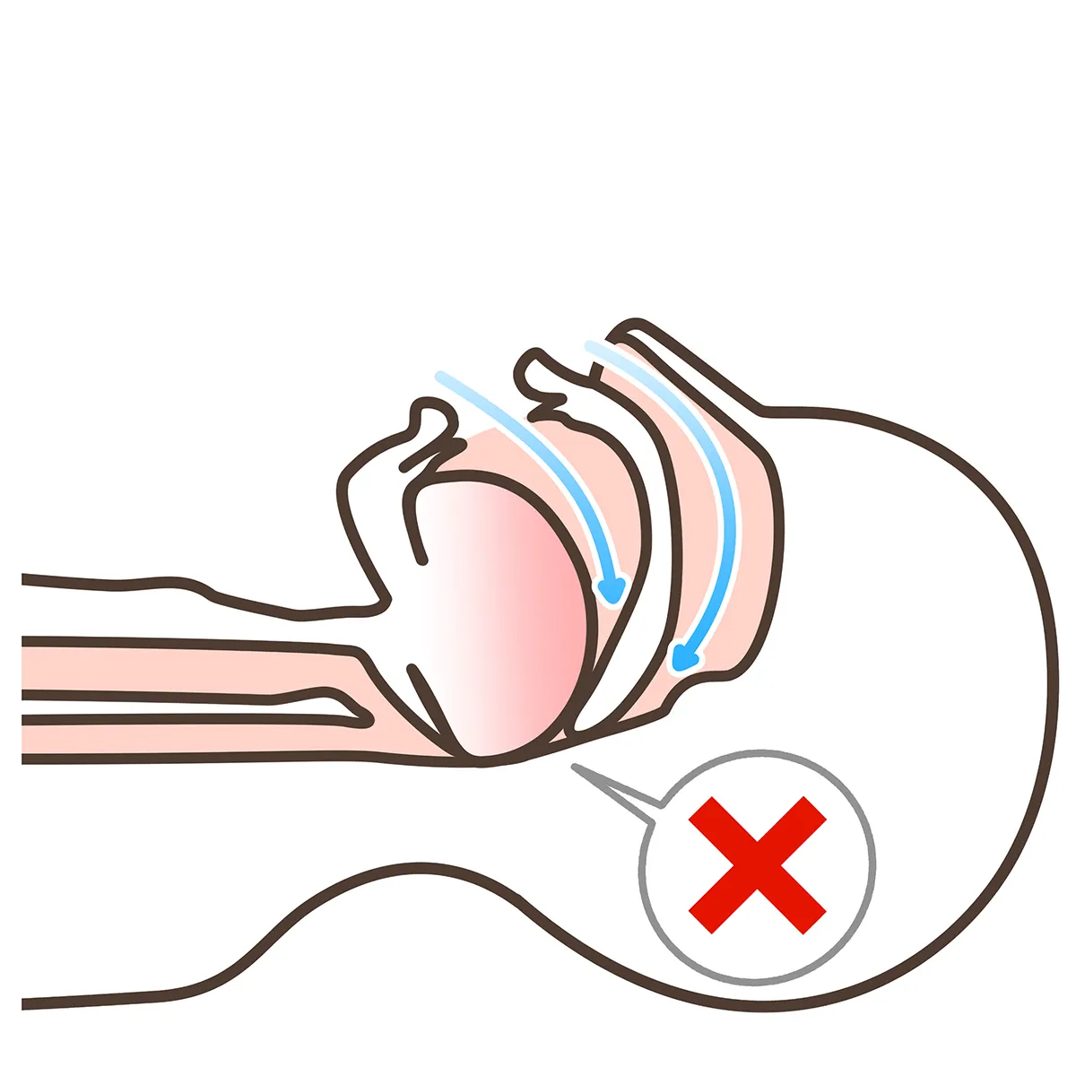 睡眠時無呼吸症候群 正常 イラスト